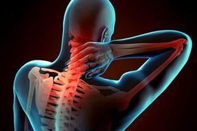 Dzemdes kakla osteohondroze