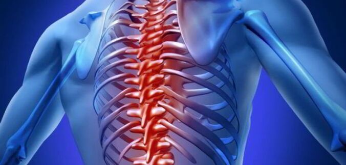mugurkaula krūšu osteohondroze